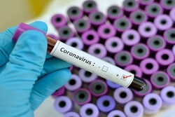 Bahreyn’de koronavirüs vakası sayısı 17’ye yükseldi
