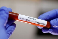 اجازه استفاده از فناوری های جدید تشخیص ویروس کرونا در آمریکا