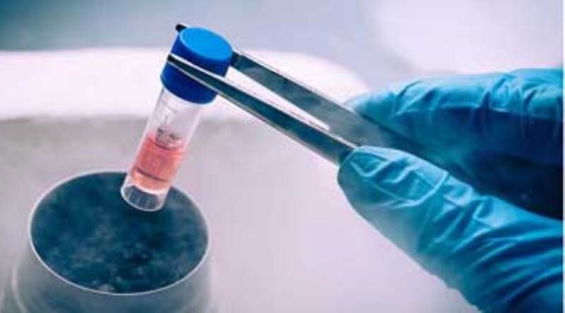 پیشتازی ایران در تولید علم سلول بنیادی در منطقه/ رتبه ۶ جهانی در تولید محصولات ژن و سلول درمانی