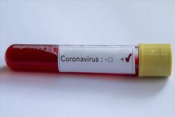 ۱۲۰ مورد آزمایش تشخیص کرونا ویروس در استان انجام شده است