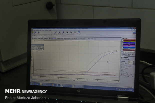 آزمایشگاه تخصصی تشخیص کووید 19 در اهواز