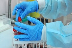 روس میں کورونا وائرس سے  اب تک 17 ہزار سے زائد افراد ہلاک