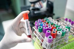 Rusya'da 11 bin 12 yeni koronavirüs vakası saptandı