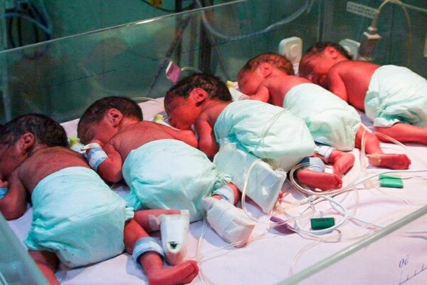 تولد چند قلوها در گچساران/سه مادر ۹ فرزند به دنیا آوردند