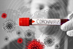 Iran unveils nano-test kit for coronavirus