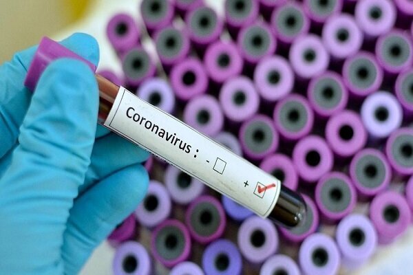 روس میں کورونا وائرس سے اب تک 5 ہزآر سے زائد افراد ہلاک