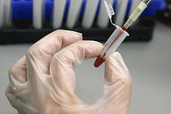 افزایش ۱۰ درصدی ذخیره خون بند ناف در بانک سلول های بنیادی رویان