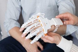 القفازات الروبوتية تساعد في إعادة تأهيل المرضى