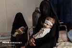 3000 طفل يمني مصاب بالسرطان معرض للموت بسبب العدوان والحصار