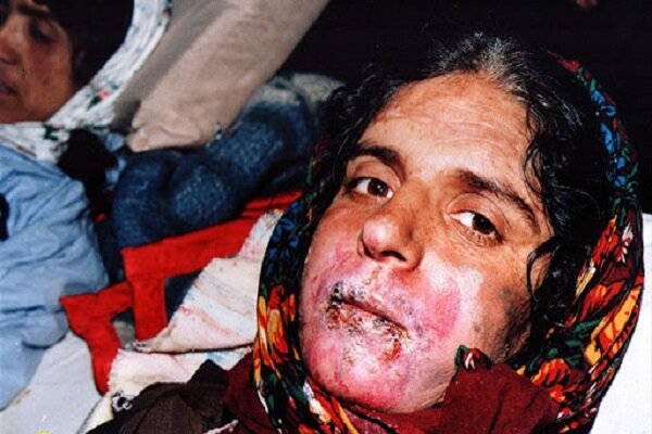 «سردشت» سند توحش مدعیان حقوق بشر/۳۵سال هم‌نشینی با تاول و خردل