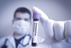 ۸۲ مورد جدید ابتلا به کرونا ویروس در استان مرکزی