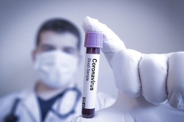 دنیا بھر میں کورونا وائرس سے ہلاکتوں کی تعداد 5 لاکھ 57 ہزار 494 ہوگئی