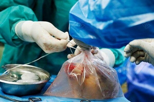 اعضای بدن جوان ۲۹ ساله اردبیلی به بیماران نیازمند اهدا شد