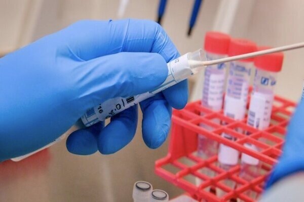  شناسایی ۷ مورد مبتلا به ویروس کرونای انگلیسی در اسکو