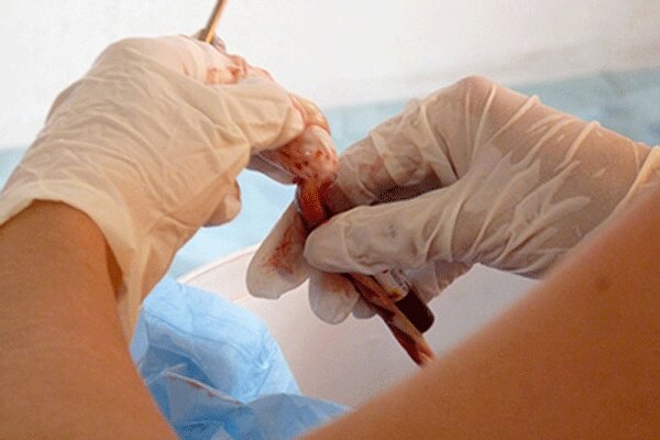 نزدیک به ۱۵۰۰ نمونه خون بند ناف در اردبیل جمع آوری شده است