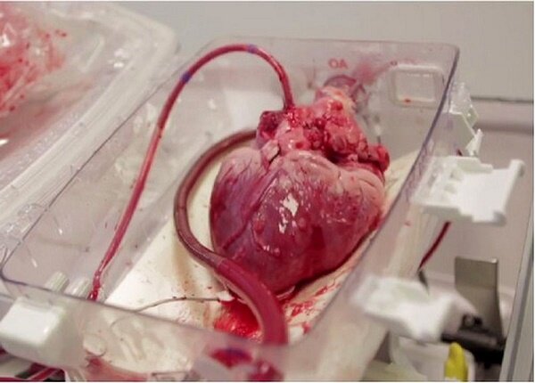 اورژانس،قلب،بيمارستان،بالگرد