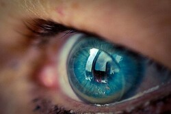 خرید لنز چشم (طبی و رنگی) اورجینال در ایران