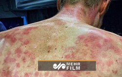دوچرخه سوارانی که گرفتار تگرگ سنگین شدند