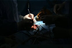 کاشت باتری قلبی زیرجلدی (S-ICD) برای اولین بار در تبریز انجام شد