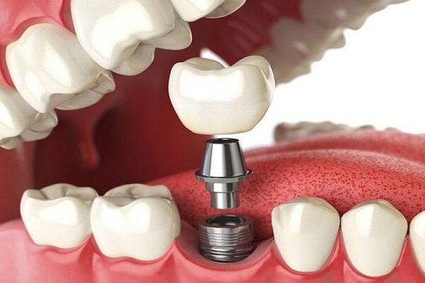 بهبود مشکلات دهان و دندان با فناوری‌های جدید پزشکی