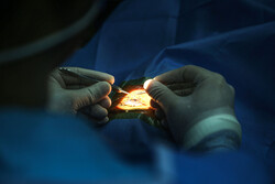 افقی تازه در درمان زخم‌های شدید قرنیه با استفاده از سلول‌های بنیادی