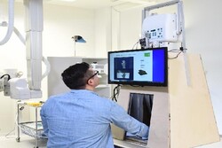 دستگاه قابل حمل اشعه ایکس برای کنترل شکستگی استخوان‌ها