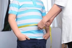 کاهش زیاد وزن به پیشگیری از ابتلا به کووید ۱۹ شدید کمک می کند