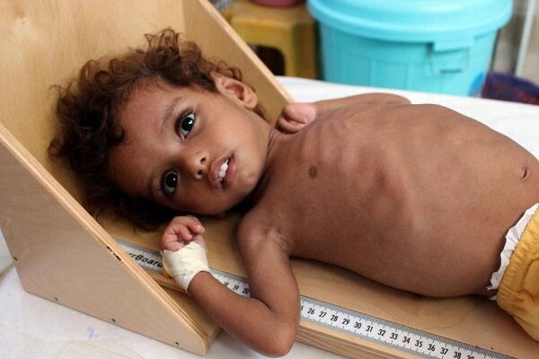 UN warns 400,000 Yemeni children may starve to death in 2021