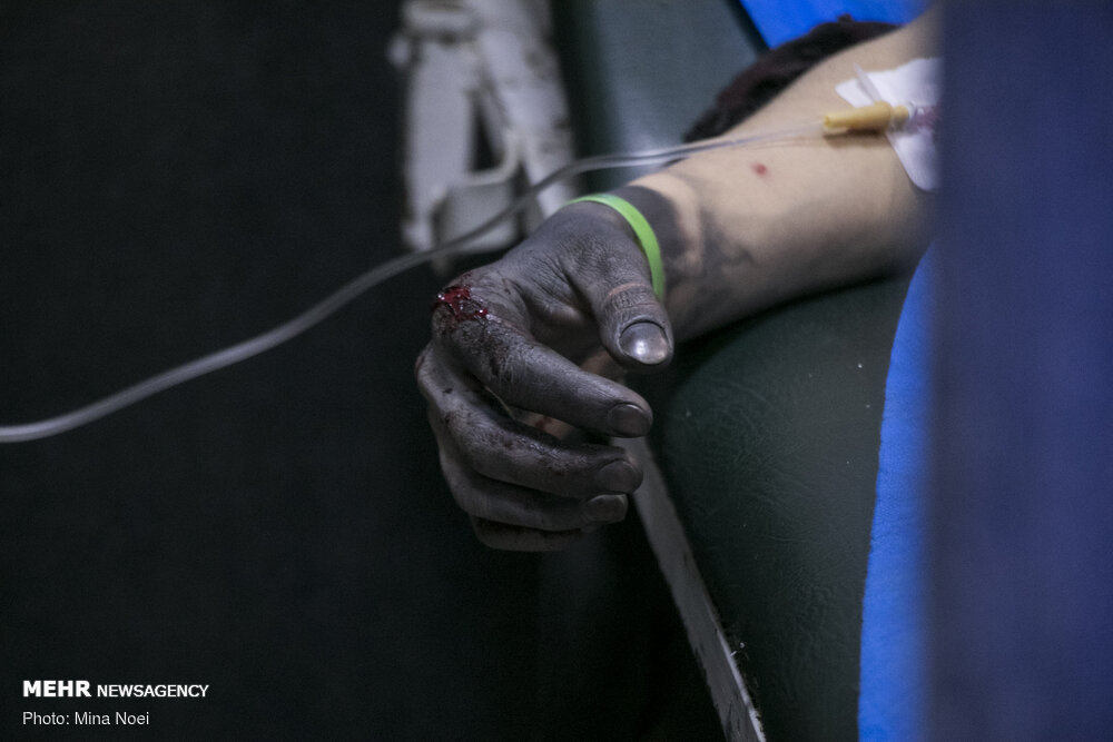 سوختگی دست و صورت یک کودک ۱۴ ساله در پی انفجار نارنجک