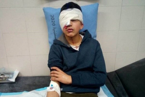 شلیک نظامیان صهیونیست و از دست رفتن بینایی چشم نوجوان فلسطینی