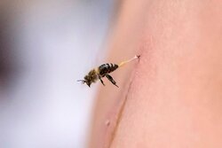 درمان روماتیسم با نیش زنبور در مصر