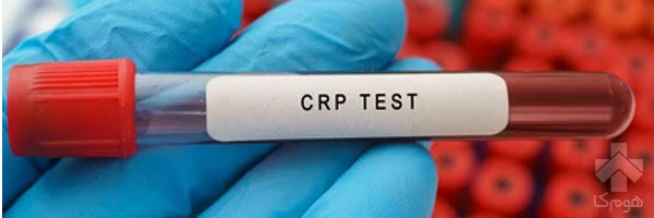 CRP یا پروتئین های التهابی در خون چیست؟