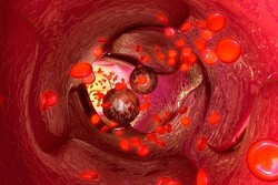 کشف نقش کلسترول در تغذیه متاستازهای سرطانی