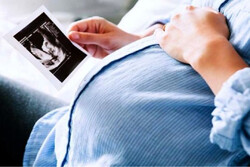 بررسی علت مرگ مادر باردار ازنایی در پزشکی قانونی