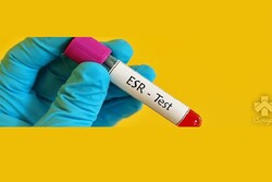 ESR در آزمایش خون چیست؟
