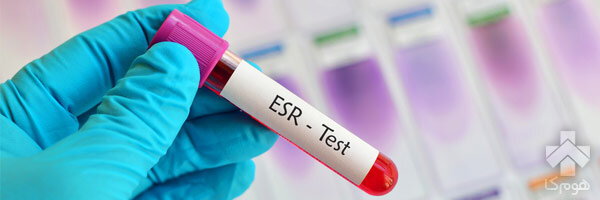 ESR در آزمایش خون چیست؟