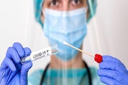 فهرست جدید آزمایشگاه‌های تشخیص کووید ۱۹ اعلام شد