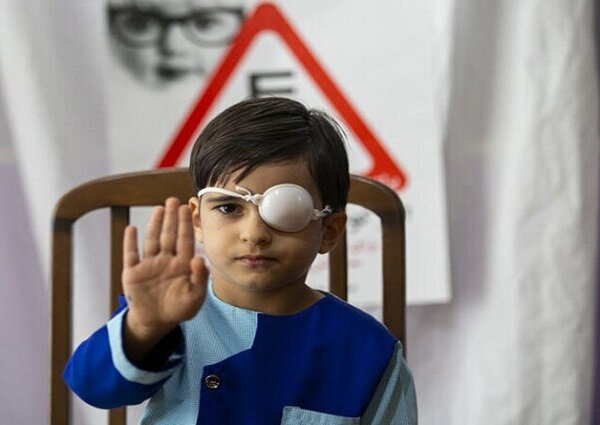 غربالگری تنبلی چشم ۲۵۰۰۰ کودک کرمانشاهی 