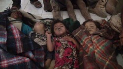 هر ١٠ دقیقه یک کودک یمنی به دلیل بیماری جان خود را از دست می دهد
