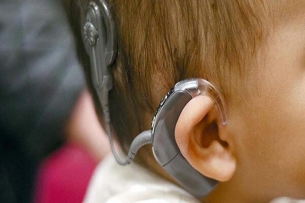 Iran firm working to produce cochlear implant internal part