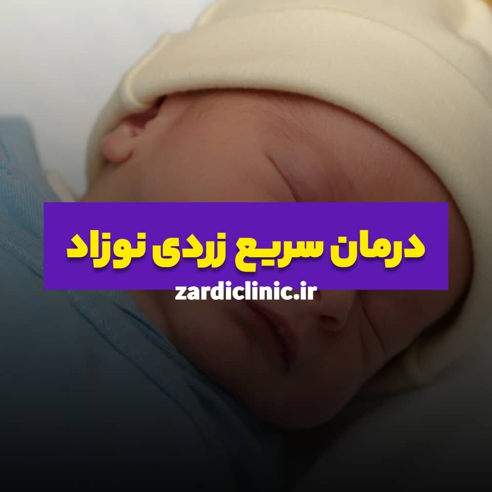 اجاره دستگاه زردی نوزاد در شرق تهران از زردی کلینیک