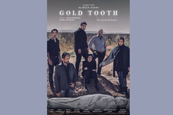 «دندان طلا» آماده نمایش شد