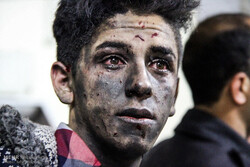 جدیدترین آمار فوتی‌ها و مصدومان چهارشنبه سوری/ چشم، در صدر بیشترین آسیب‌ها