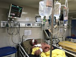 ۱۰۰ نفر شیفت بیمارستان سوانح سوختگی در چهارشنبه سوری