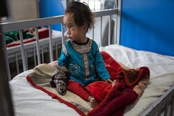 یونیسف: ۱.۱ میلیون کودک دیگر در افغانستان سوء تغذیه دارند