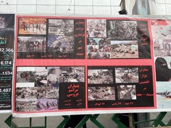 نمایش عکس‌هایی از کودکان قربانی جنگ یمن