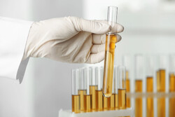 نتایج تست ۳۹ مورد مشکوک آبله میمونی/تجهیز ۱۲ آزمایشگاه در کشور