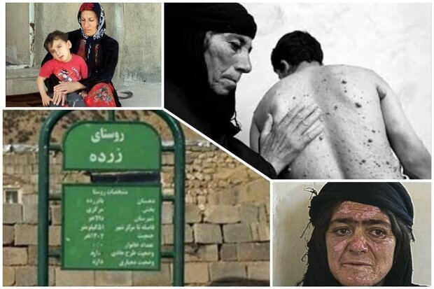 نفسهای مسموم در هیروشیمای ایران؛ زرده در انتظار التیام زخمهای کهنه نفسهای مسموم در هیروشیمای ایران؛ زرده در انتظار التیام زخمهای کهنه