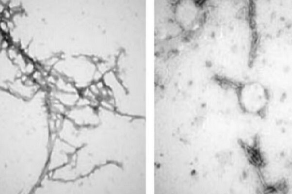 پاکسازی پروتئین‌های عامل بیماری پارکینسون با نانو بادی