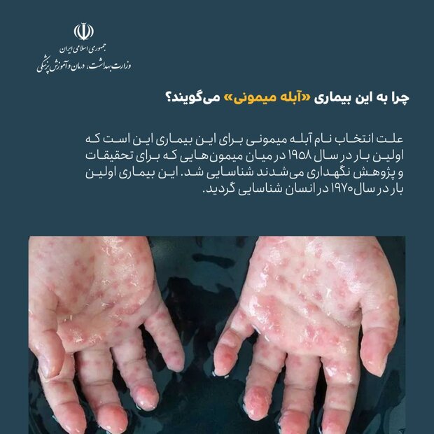 اینفوگرافی آبله میمونی/ از علائم بیماری تا راه های درمان